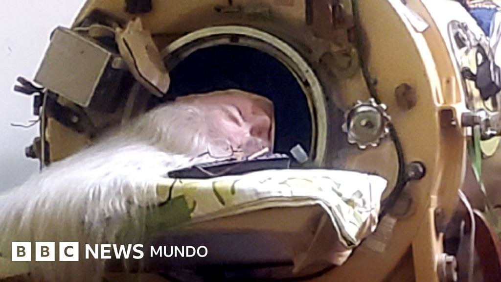 La mujer que vivió 73 años metida varias horas al día en un pulmón de acero que le permitía respirar