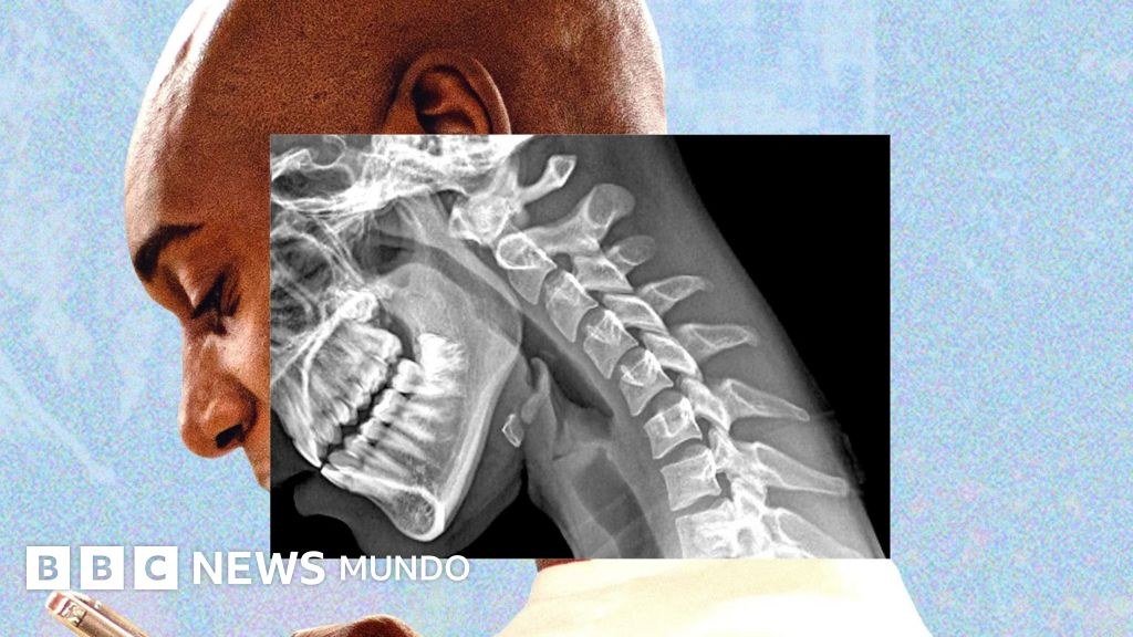 "Cuerpo de teléfono": cómo la tecnología nos arruga el cuello y debilita las manos